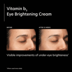 Alternative view of PCA Skin Vitamin B3 Eye Brightening serum