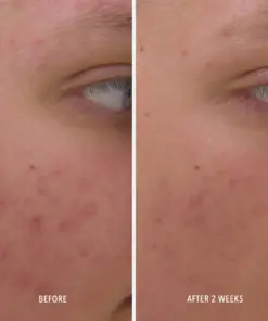 HydroPeptide Clear Rescue Serum